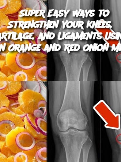 8 Super Easy Ways to Strengthen Your Knees, Cartilage, and Ligaments Using an Orange and Red Onion Mix