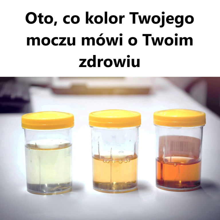 Oto, co kolor Twojego moczu mówi o Twoim zdrowiu