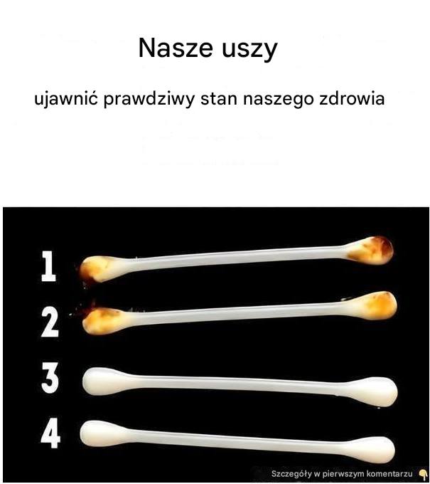 Nasze uszy ujawniają prawdziwy stan naszego zdrowia