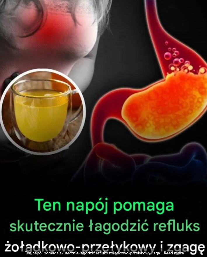 Tytuł: Naturalny napój łagodzący refluks i zgagę – ukojenie dla żołądka w jednej szklance