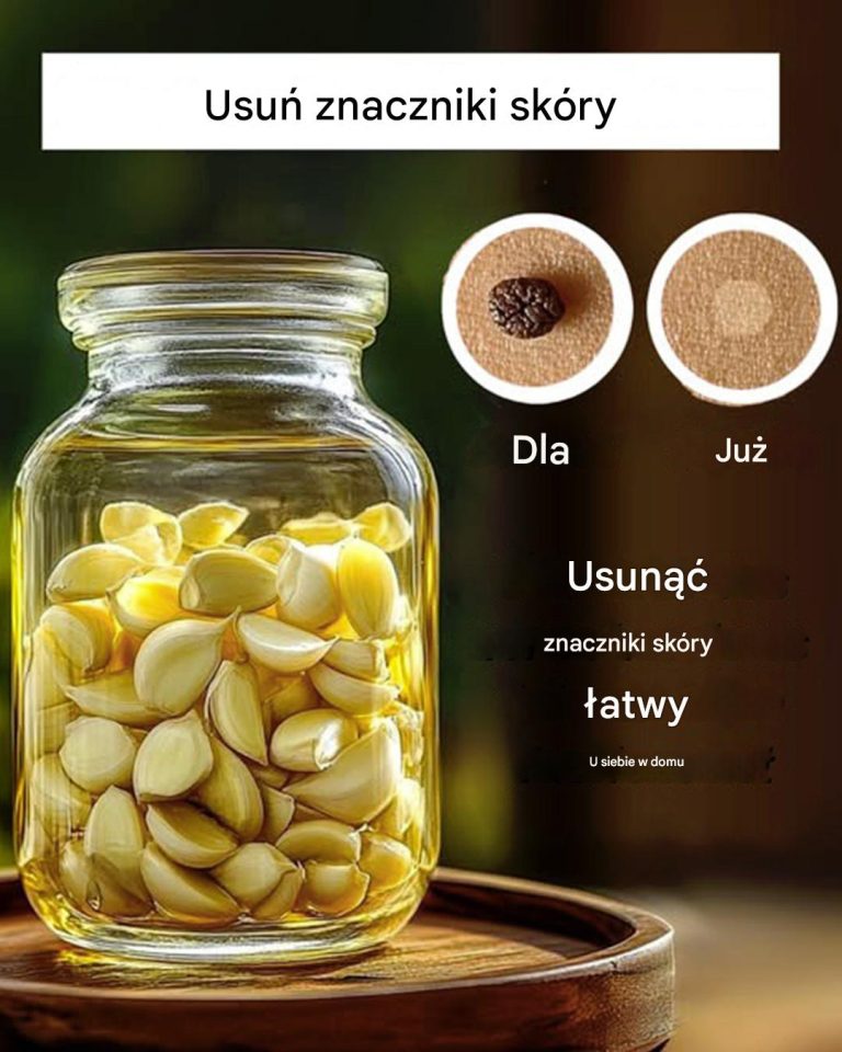 3 domowe sposoby na pozbycie się narośli skórnych