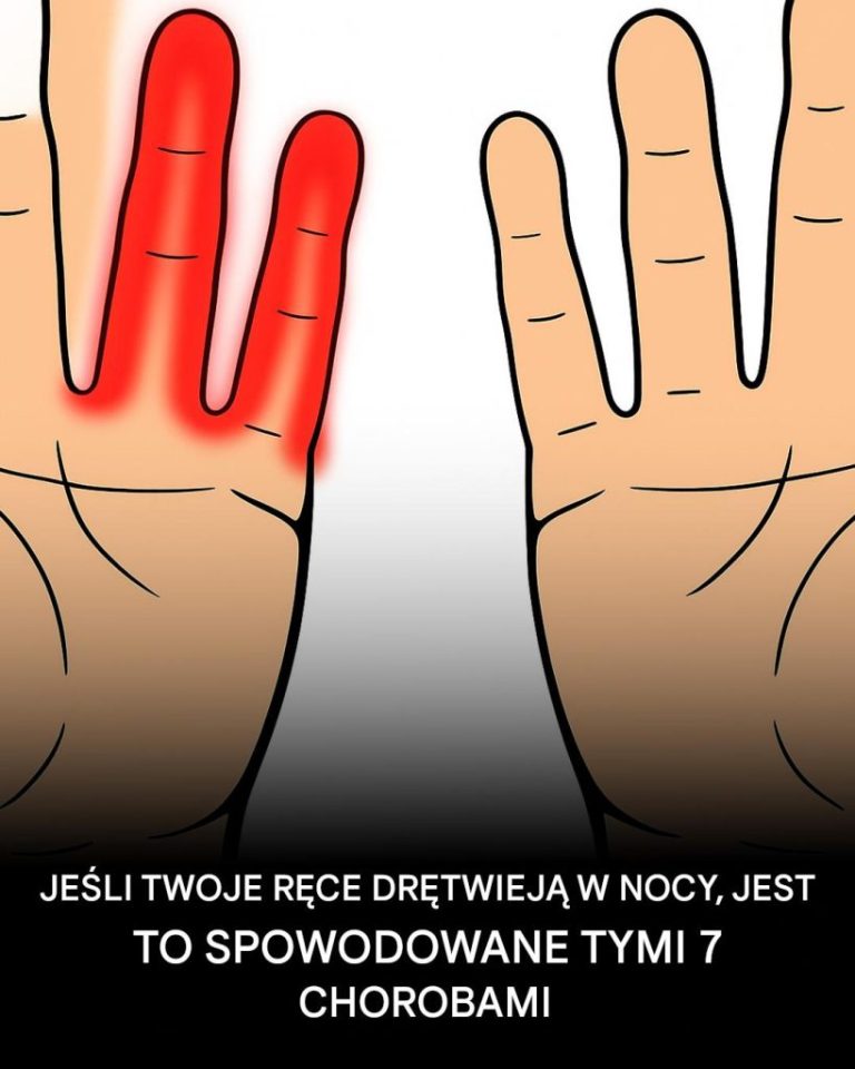 Dlaczego w nocy drętwieją ręce?