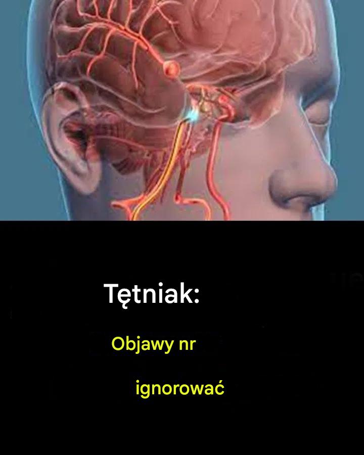Tętniak: Objawy, których nie należy ignorować